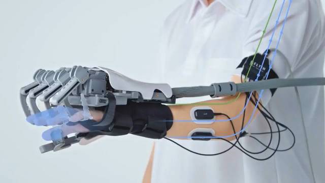 xc体育股份有限公司动态 - AI大模型DeepSeek助力运动处方决策开创个性化康复新模式